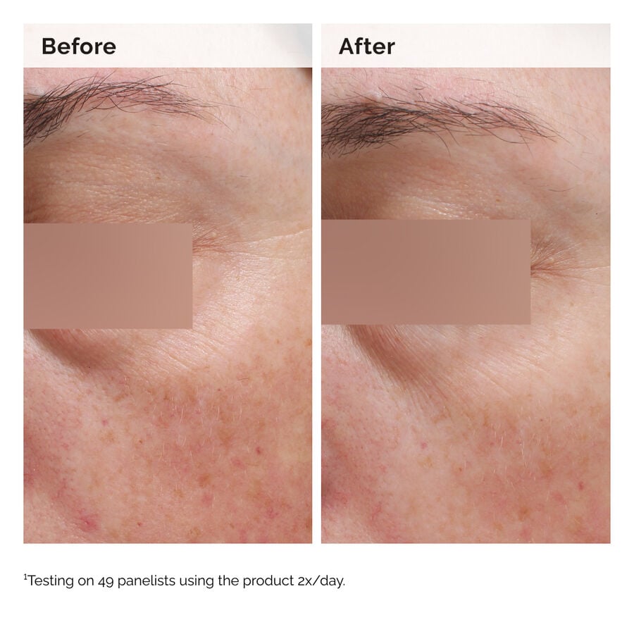 niacinamide-5-face-and-body-emulsion-k7 2024-08-23-ORD-Nia-5pct-Face-Body-B-A-Elasticity-Global-02-1x1.jpg