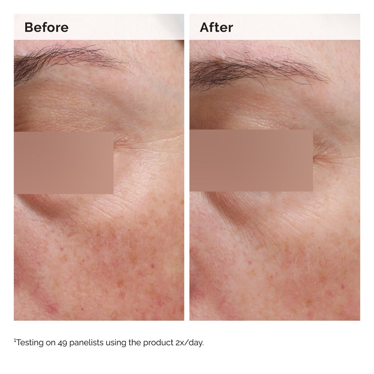 niacinamide-5-face-and-body-emulsion-k7 2024-08-23-ORD-Nia-5pct-Face-Body-B-A-Elasticity-Global-02-1x1.jpg