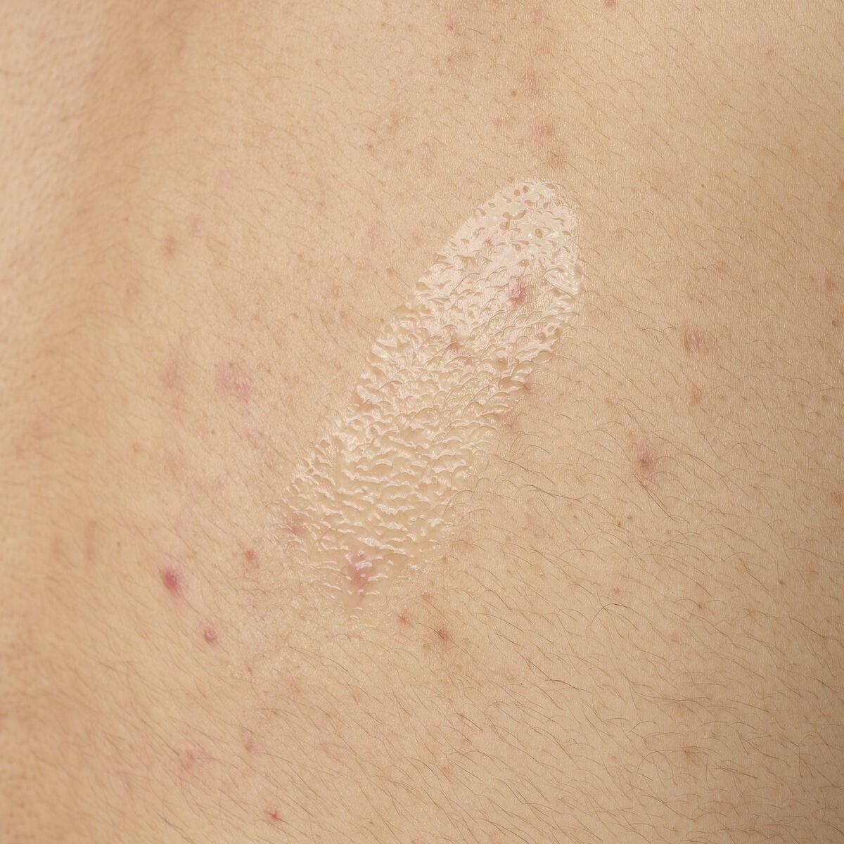 salicylic-acid-0-5-body-serum-d5 ORD-salicylic-acid-05-body-240ml-application.jpg