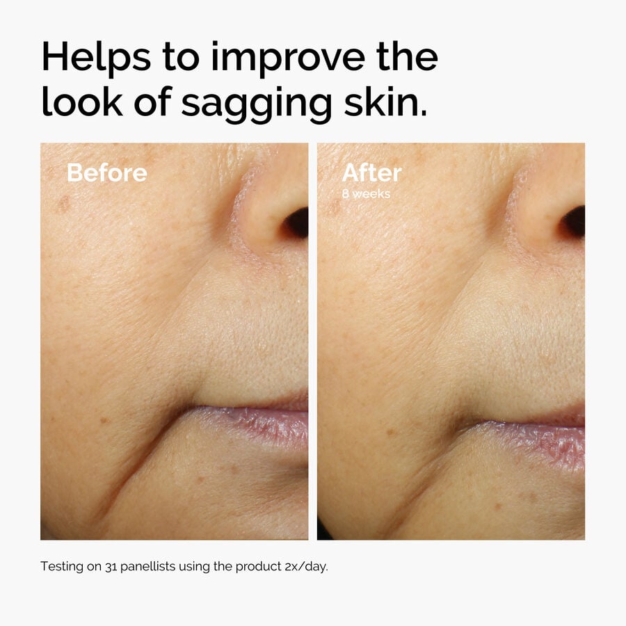 caffeine-3-escin-1-face-serum-a8 ord-caffeine-3pct-escin-1pct-face-serum-before-after-sagging.jpg