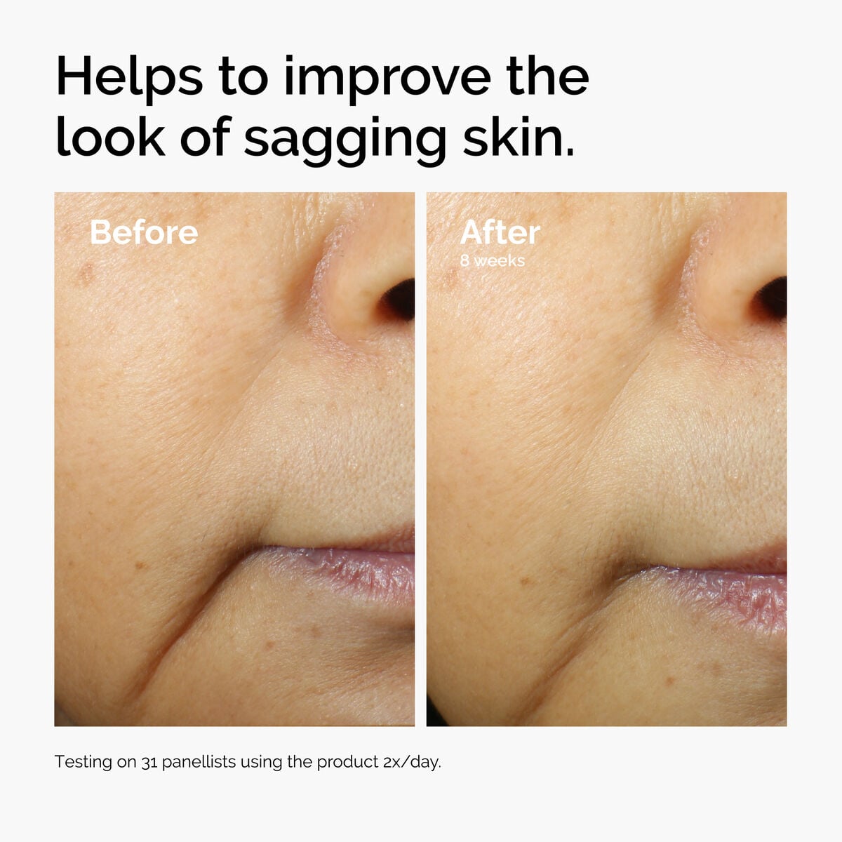 caffeine-3-escin-1-face-serum-a8 ord-caffeine-3pct-escin-1pct-face-serum-before-after-sagging.jpg