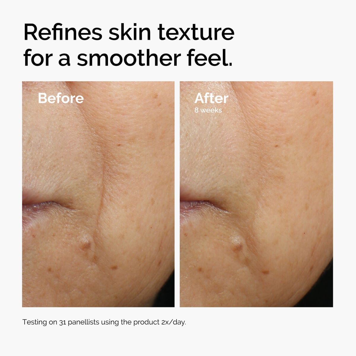 caffeine-3-escin-1-face-serum-a8 ord-caffeine-3pct-escin-1pct-face-serum-before-after-texture.jpg