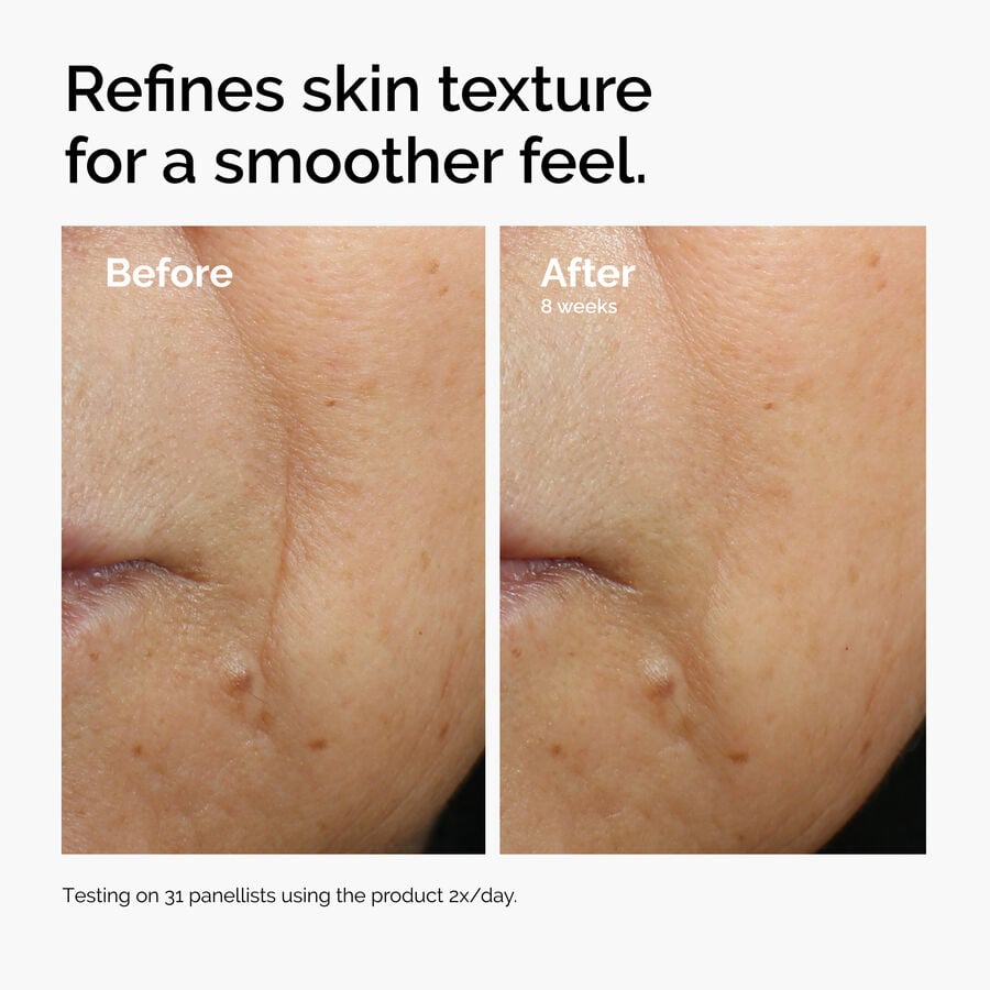 caffeine-3-escin-1-face-serum-a8 ord-caffeine-3pct-escin-1pct-face-serum-before-after-texture.jpg