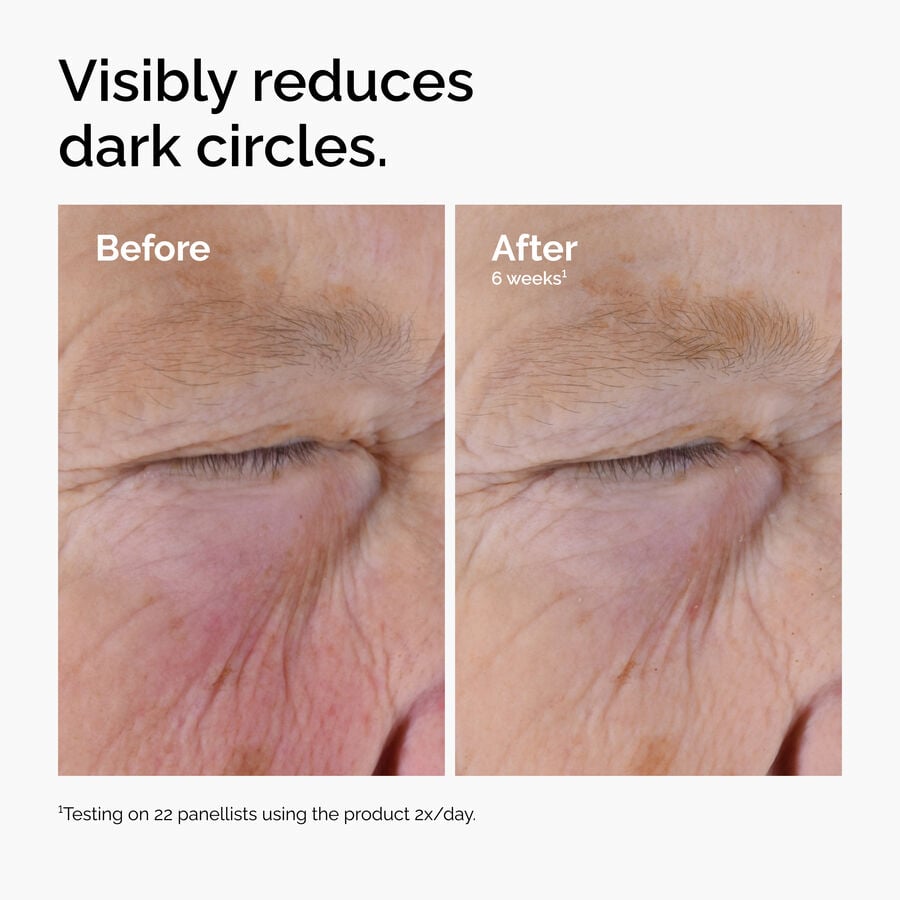caffeine-solution-5-egcg-eye-serum-s5 ord-caffeine-solution-egcg-dark-circles-before-after.jpg