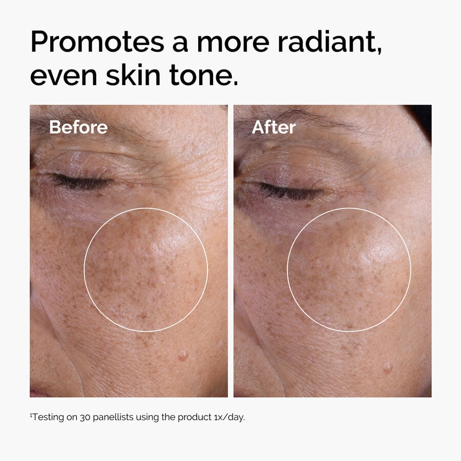 glycolic-acid-7-exfoliating-toner-q0 ord-glycolic-before-after-radiance.jpg