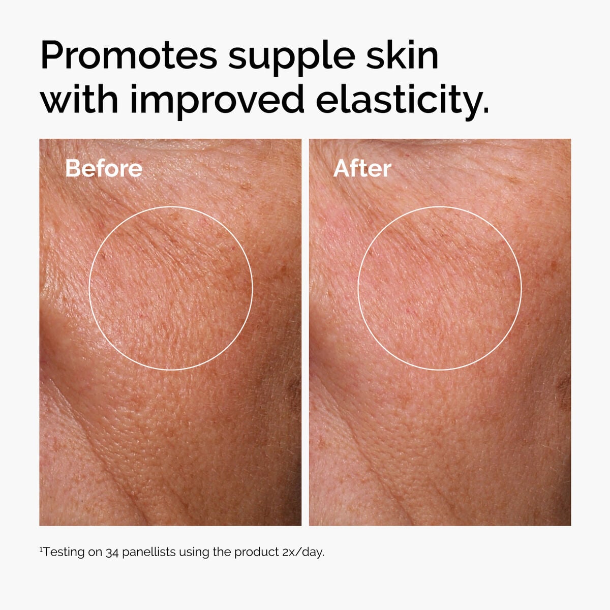 hyaluronic-acid-2-b5-with-ceramides-m0 ord-hyaluronic-acid-2pct-b5-hydrating-serum-before-after-elasticity.jpg
