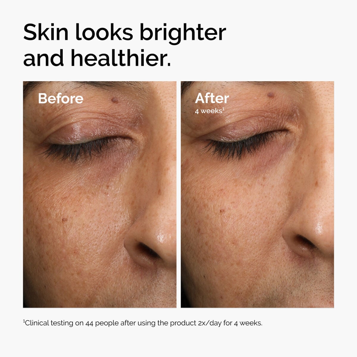 multi-antioxidant-radiance-serum-x7 ord-mars-before-after-healthy.jpg