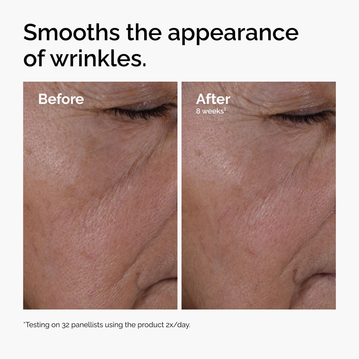 multi-peptide-ha-serum-s0 ord-multi-peptide-ha-serum-wrinkles-before-after.jpg