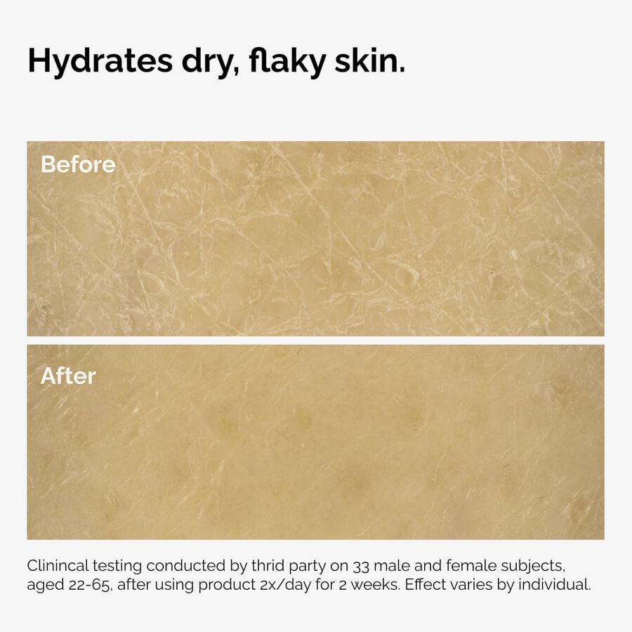the-body-care-collection-f6 ord-natural-moisturizing-factors-inulin-body-before-after-graphic-02.jpg