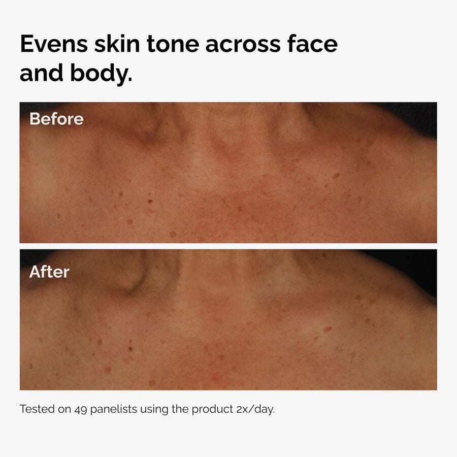 the-body-care-collection-f6 ord-niacinamide-face-body-serum-before-after-even-tone-graphic.jpg