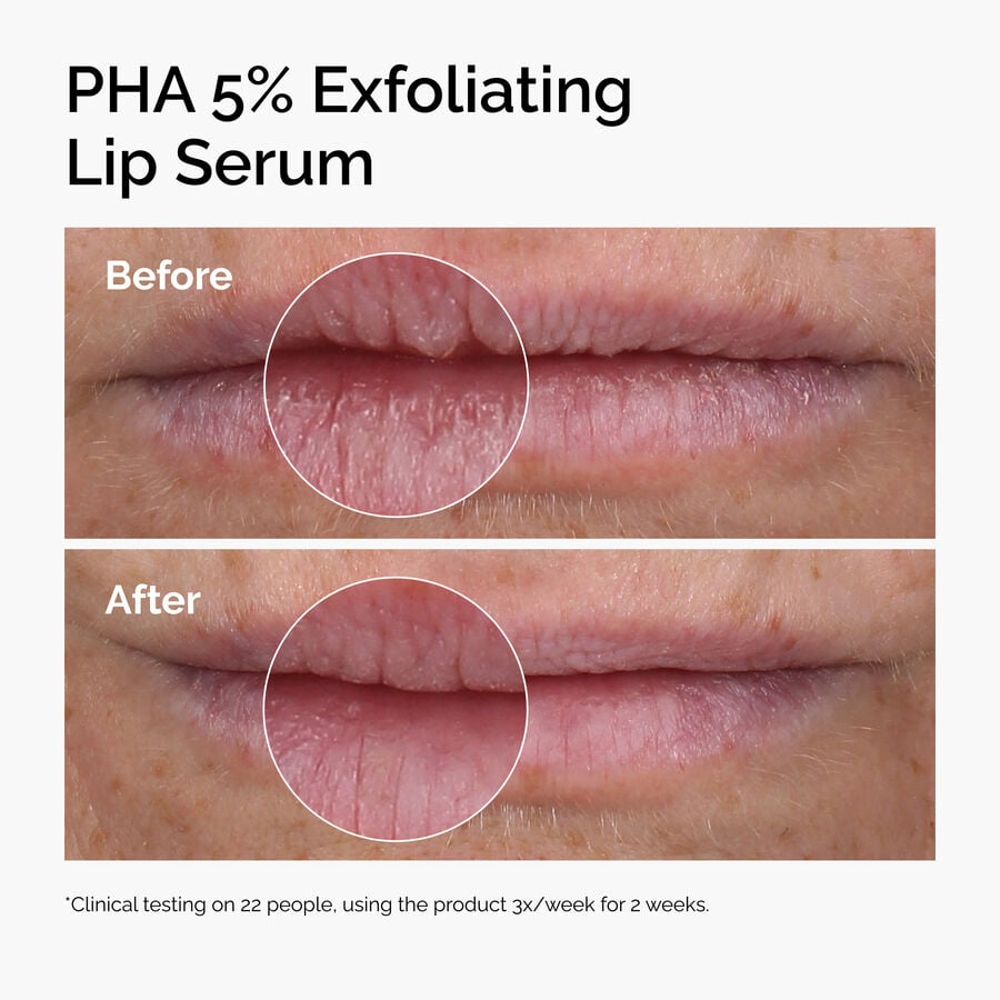 pha-5-exfoliating-lip-serum-y8 ord-pha-5pct-lip-exfoliating-serum-before-after.jpg