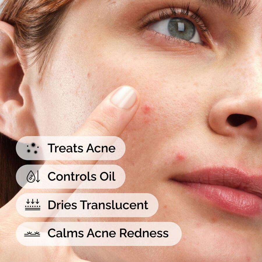 sulfur-10-powder-to-cream-concentrate-k9 ord-sulfur-10pct-powder-to-cream-concentrate-model-application-with-benefits-acne.jpg